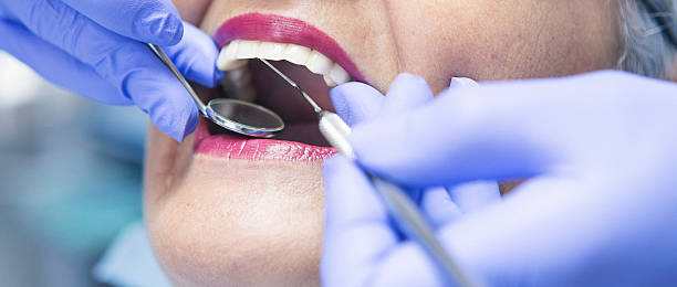 Best Emergency Dental Services for Seniors in Sunnyvale, CA